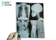 10 * 12 cali PET Medyczny film obrazowy Suchy film rentgenowski do drukarek atramentowych
