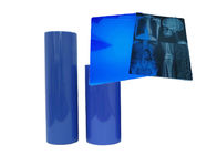 Cyfrowy rentgenowski film obrazowy Niebieski wrażliwy film rentgenowski do tomografii komputerowej