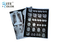 Podstawowa folia PET z promieniowaniem rentgenowskim Film radiologiczny Folia obrazowa do DR CT 100 arkuszy w opakowaniu