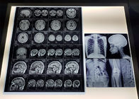 Wodoodporna medyczna folia rentgenowska na bazie PET o grubości 215 mikronów
