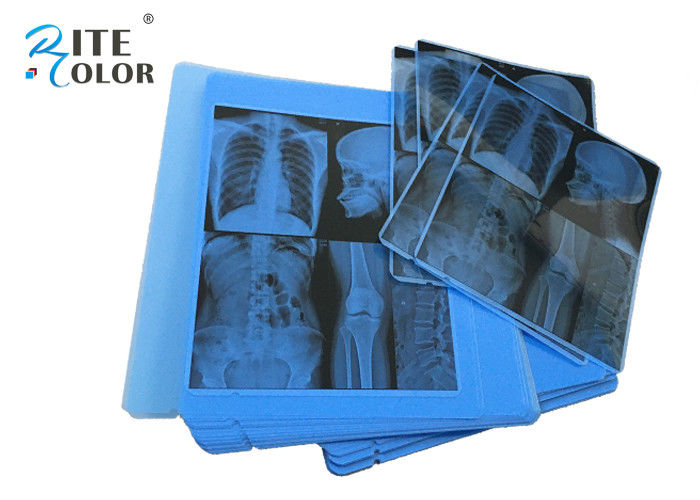 Radiologia Blue X Ray Medical Imaging Film Grubość 210um do drukarek atramentowych Epson