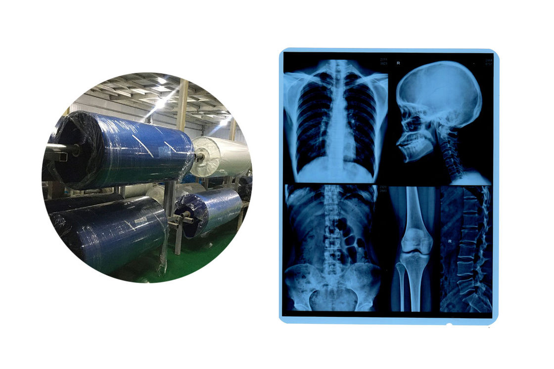 8x10 210 mikronów niebieska podstawa X Ray Medical Imaging Film