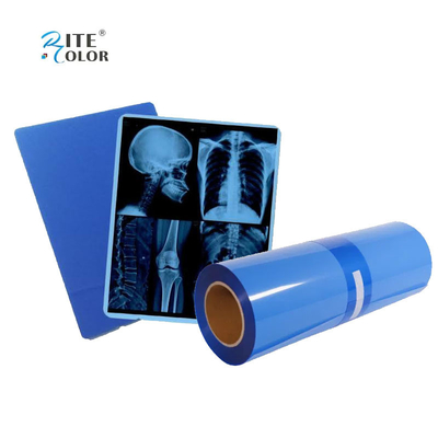 IMATEC Blue PET Inkjet Medical CR X-Ray Radiography Film Do drukarek Canon
