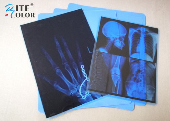 Niska mgła Blue PET Inkjet Medical Imaging Film 8 x 10 cali do drukarki Epson