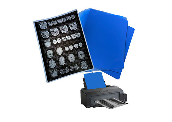 210um 8x10 A3 A4 Błękitna folia atramentowa medyczna do radiologii